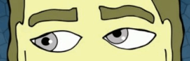 trochlear-nerve-palsy-eye