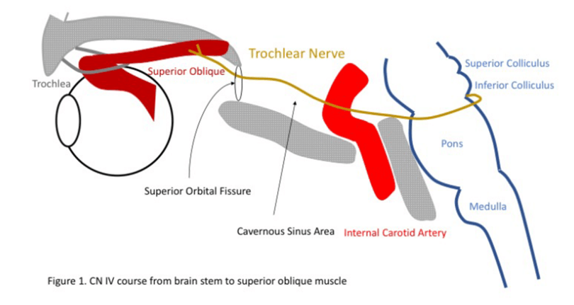 trochlear nerve pathway